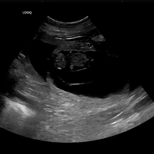 Sono vom 10.02.2025